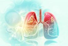 Over 66 per cent TB patients consent to government’s community adoption and care plan